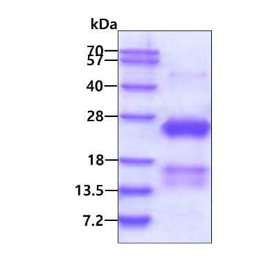 SDS-Page: Recombinant Human CSRP2 His Protein [NBP1-98997] - 3ug by SDS-PAGE under reducing condition and visualized by coomassie blue stain.